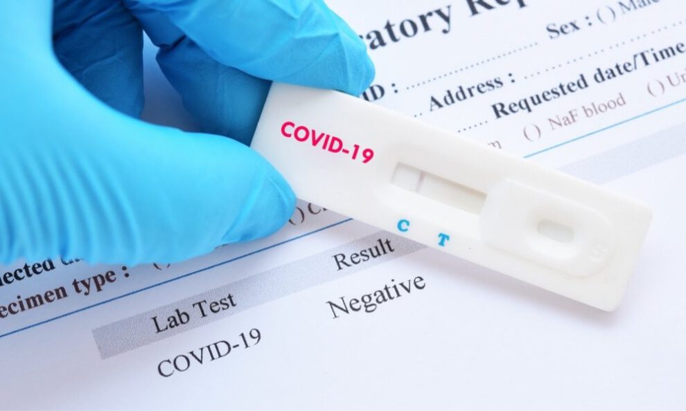 Descenso de casos positivos de Covid-19 en el país