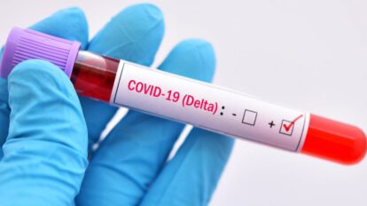 La variante Delta del Covid-19 es tan contagiosa como la varicela