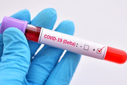 La variante Delta del Covid-19 es tan contagiosa como la varicela