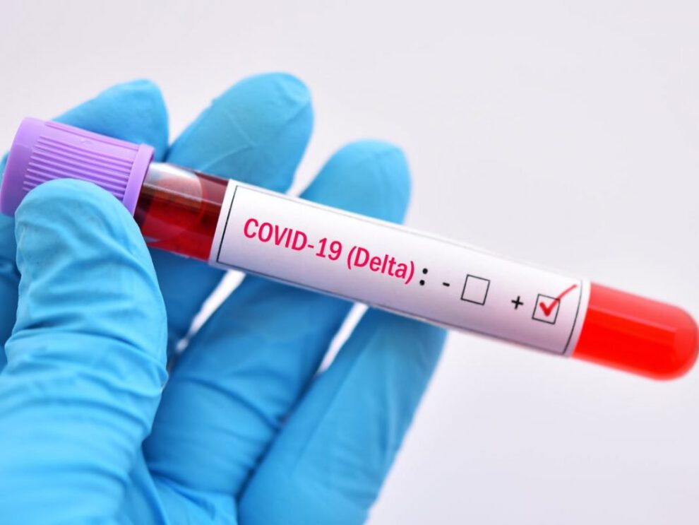 La variante Delta del Covid-19 es tan contagiosa como la varicela