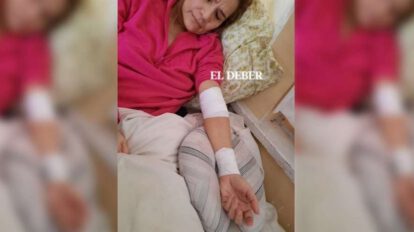 El estado de salud de Jeanine Añez empeora cada día