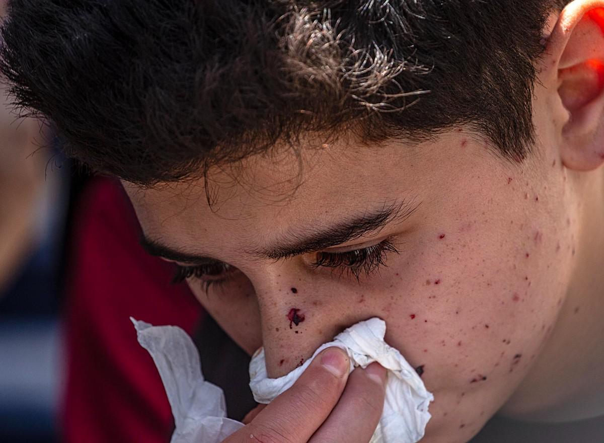 Un niño herido, hijo de Abdallah Abu Kaloub, llora cerca de los cuerpos cubiertos de su padre y su esposa
