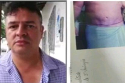 Denuncia a clínica de cirugía plástica por presunta mala praxis