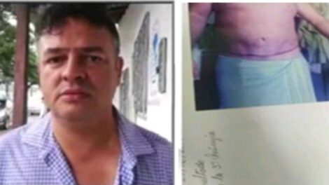 Denuncia a clínica de cirugía plástica por presunta mala praxis