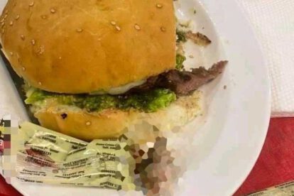Dedo hallado en hamburguesa en Santa Cruz