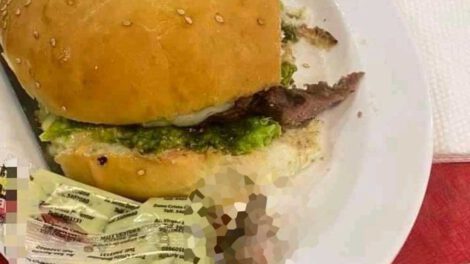 Dedo hallado en hamburguesa en Santa Cruz