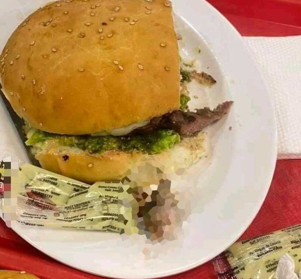 Dedo hallado en hamburguesa en Santa Cruz