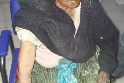 La anciana está internada recibiendo la vacuna contra la rabia humana