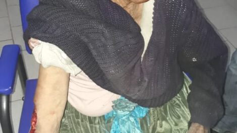 La anciana está internada recibiendo la vacuna contra la rabia humana