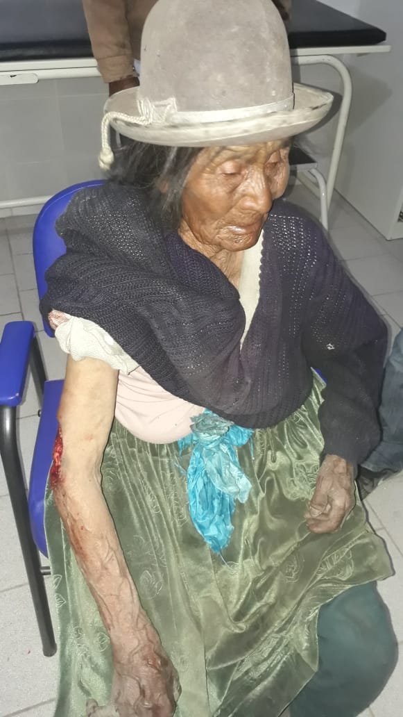 La anciana está internada recibiendo la vacuna contra la rabia humana