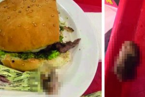 Dedo hallado en una hamburguesa en Hot Burger