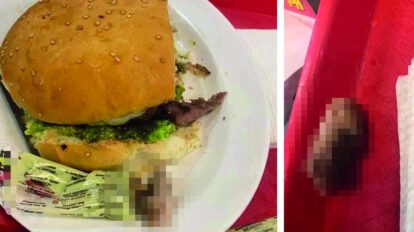 Dedo hallado en una hamburguesa en Hot Burger