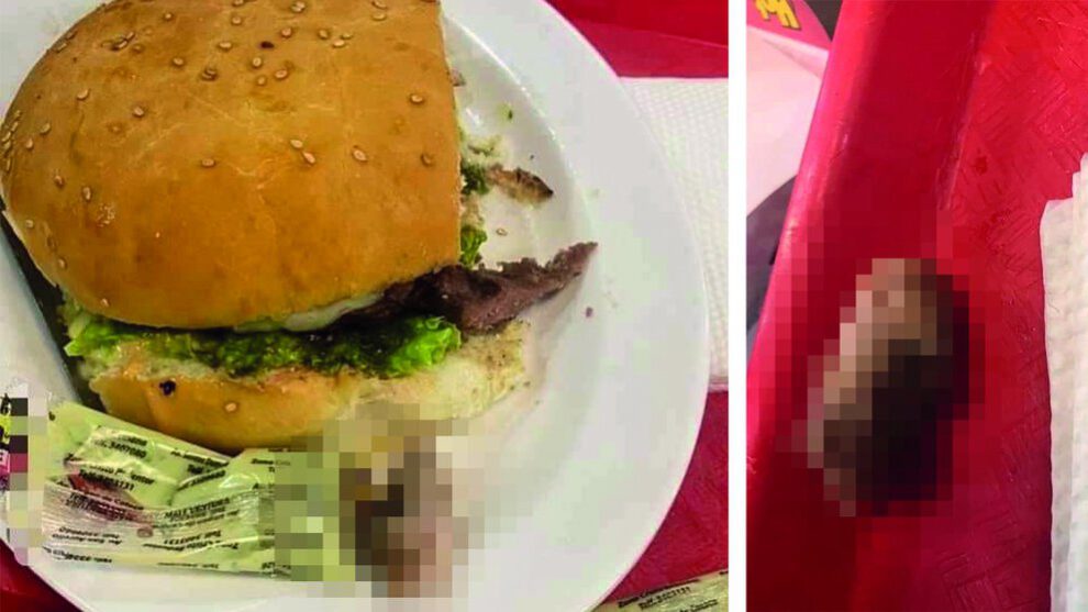 Dedo hallado en una hamburguesa en Hot Burger
