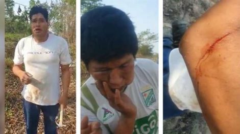 Avasalladores atacan a tiros en San Julián