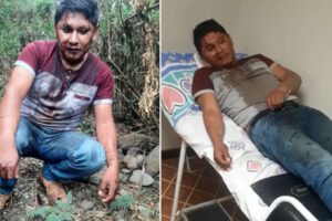 Armin Lluta torturado y ensangrentado en la Cumbre