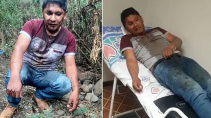 Armin Lluta torturado y ensangrentado en la Cumbre
