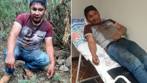Armin Lluta torturado y ensangrentado en la Cumbre