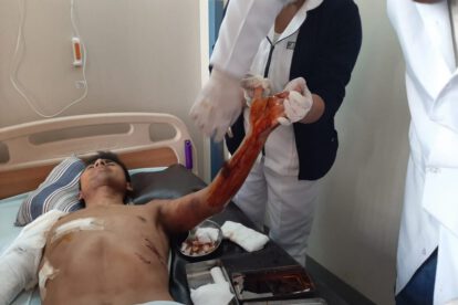 Atleta orureño atacado por jauría, Daniel Toroya en recuperación