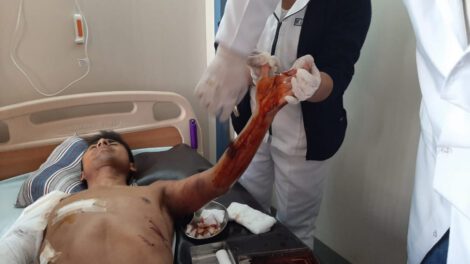 Atleta orureño atacado por jauría, Daniel Toroya en recuperación