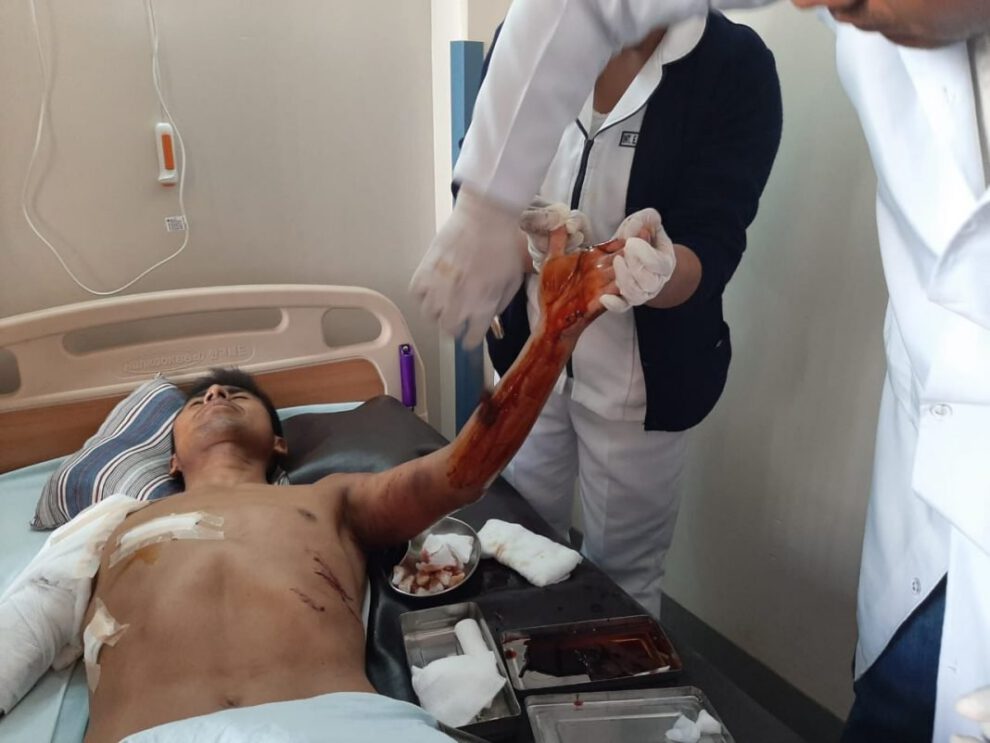 Atleta orureño atacado por jauría, Daniel Toroya en recuperación