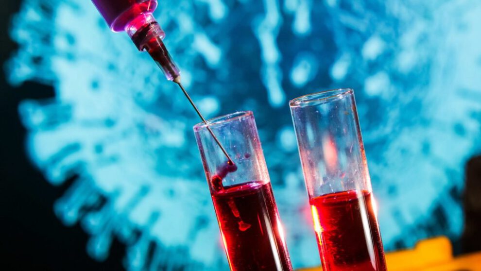 Test rápido coronavirus desarrollado por investigadores chinos