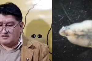 Fasciola hepática. afecta gravemente al sistema digestivo, registra una presencia importante en las comunidades aledañas al lago Titicaca