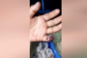 Mano herida