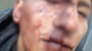 Víctima con heridas en el rostro tras agresión