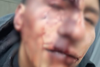Víctima con heridas en el rostro tras agresión