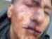 Víctima con heridas en el rostro tras agresión