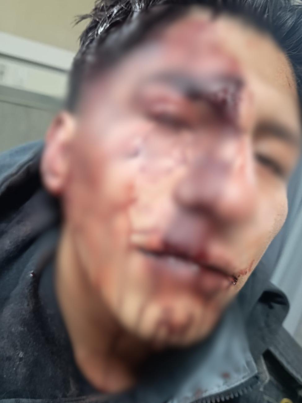 Víctima con heridas en el rostro tras agresión