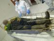 Cuerpo del minero fallecido al ingresar al área médica