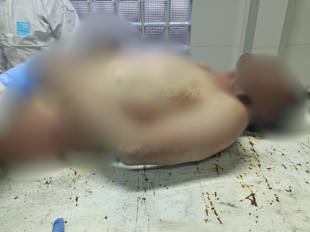 Procedimiento médico-legal a cargo del personal forense