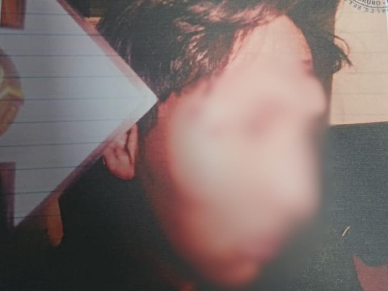 Joven agredido tras ser confundido