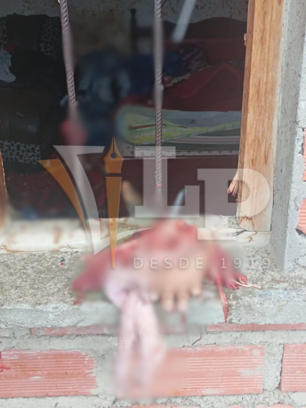 Restos de una mano en la escena que evidencian la magnitud de la detonación