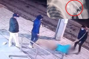 Personas arrastrando a un paciente más un radiografía