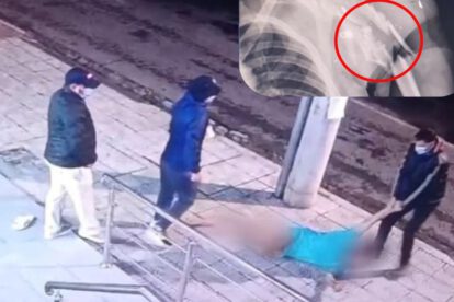 Personas arrastrando a un paciente más un radiografía