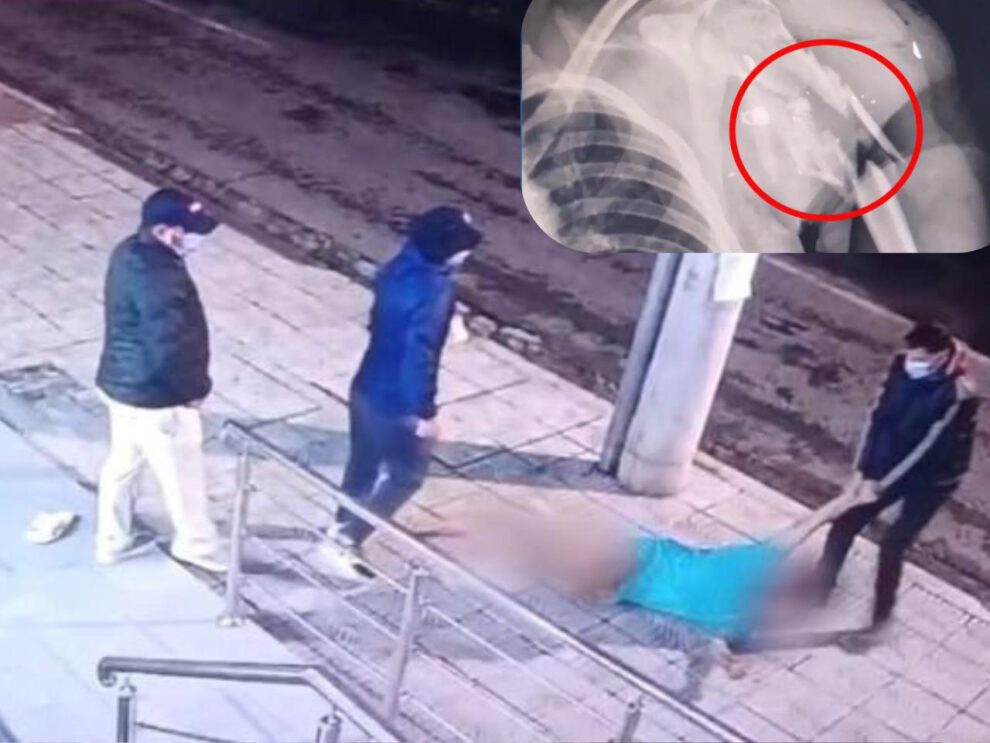 Personas arrastrando a un paciente más un radiografía