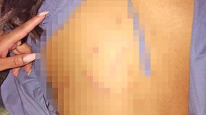 Espalda de una niña
