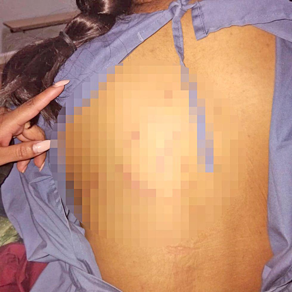 Espalda de una niña
