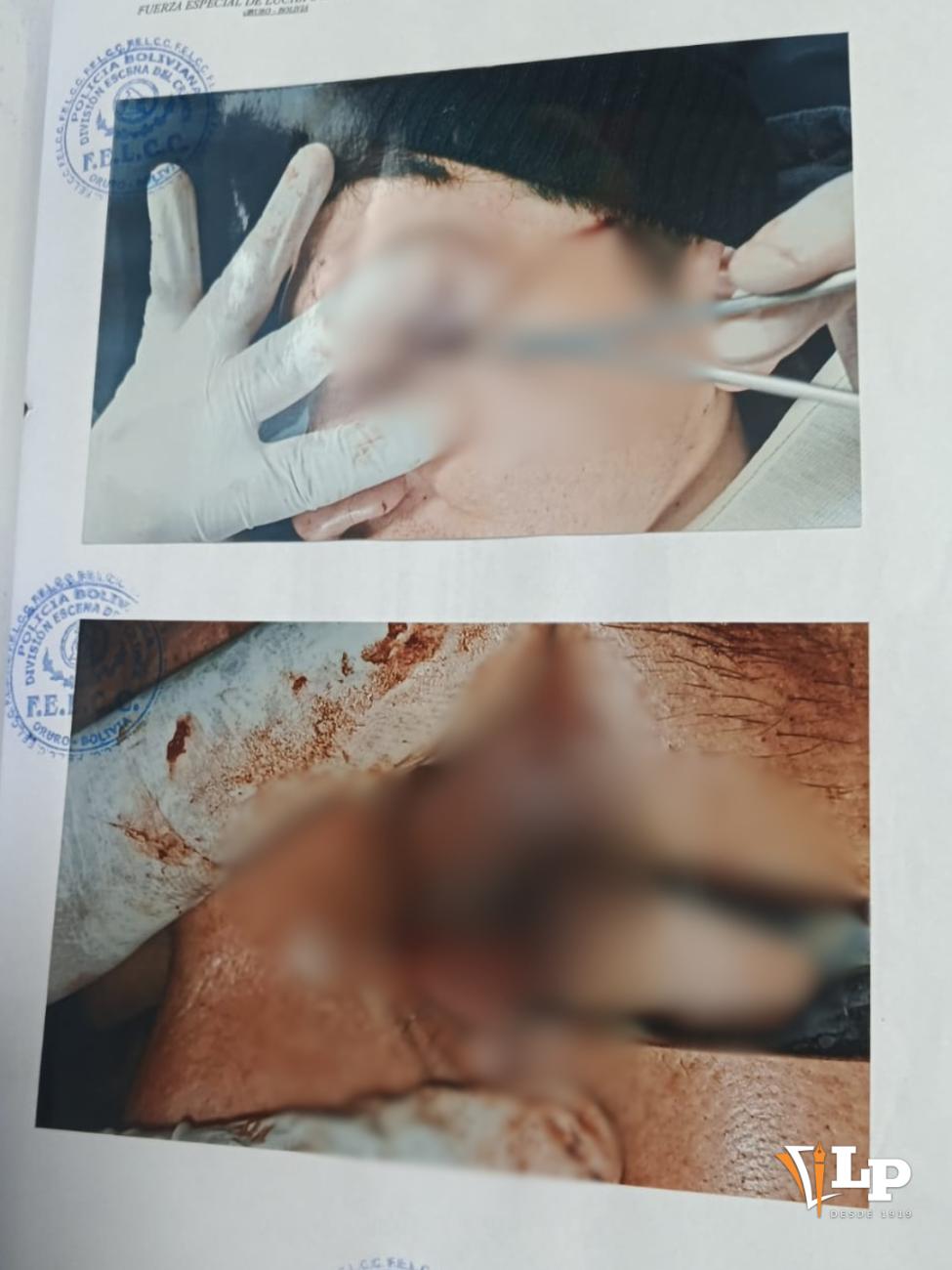 Las lesiones en el rostro y ojo requirieron cirugía de emergencia