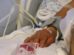 Una personas hospitalizada