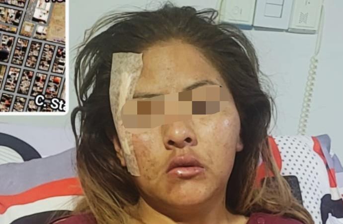 Imagen de la victima