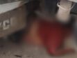 mujer atropellada