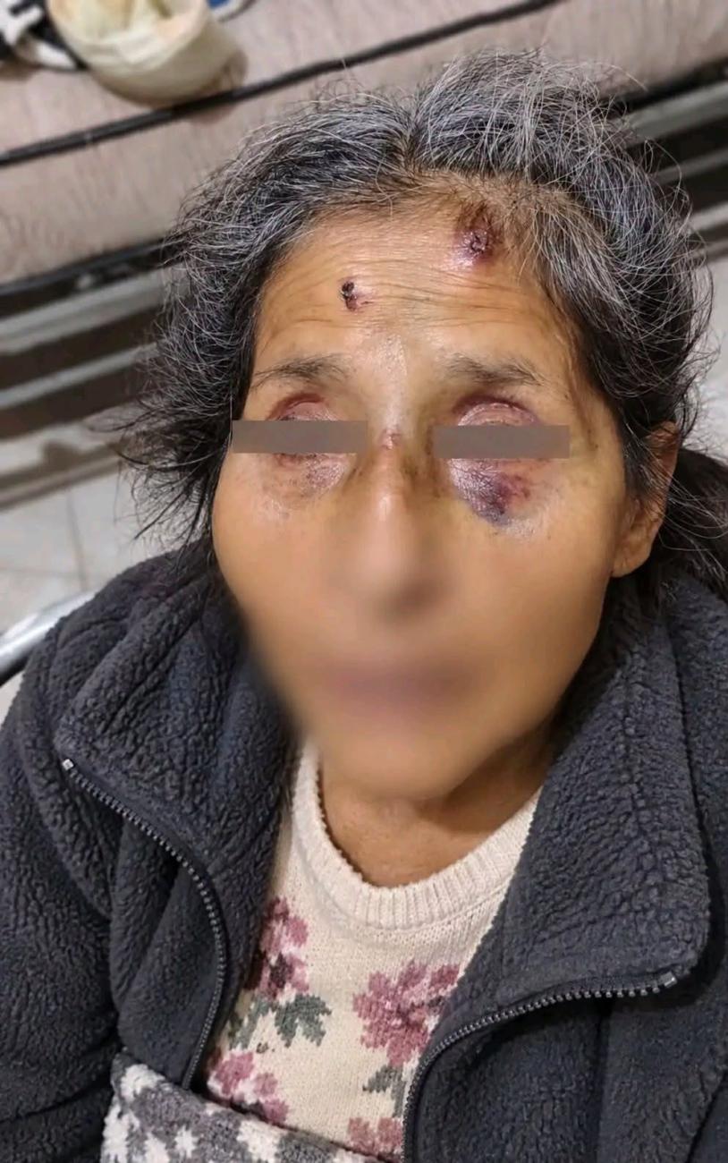 mujer golpeada