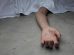 imagen referencial a un cadaver